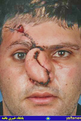 پس از حمله‌ي گرگ: هزينه درمان چهره جوان خرم‌آبادی بالاست + عكس